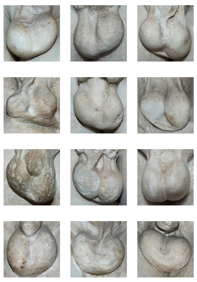 Marbles, Photo Series Focuses on the Testicles of European Greek Statues