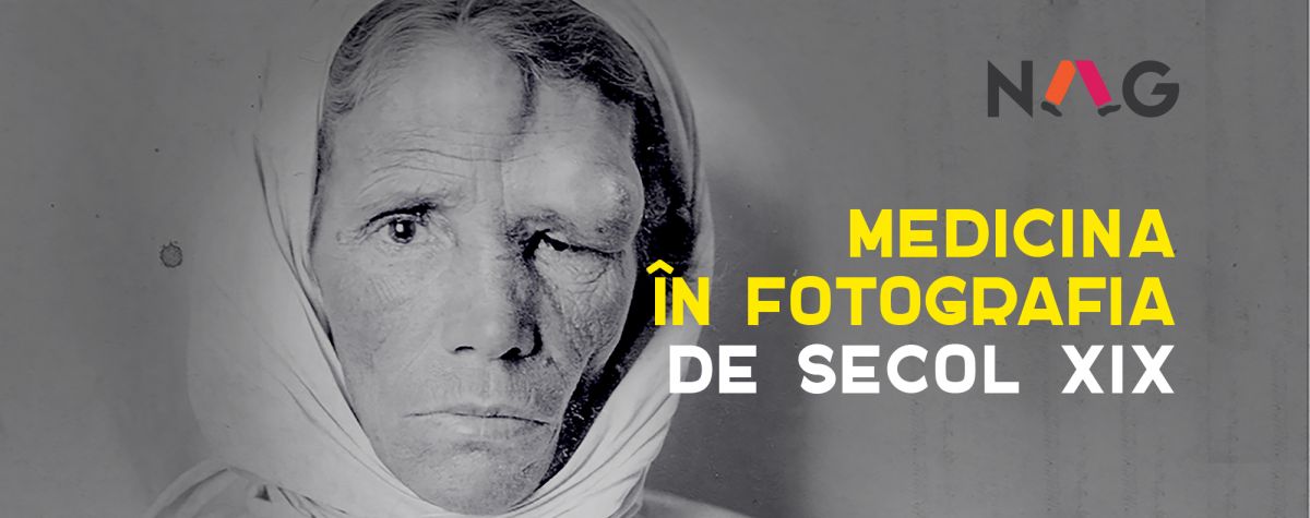 Primele fotografii medicale din România în expoziţia „Medicina în fotografia de secol XIX” la NAG 2016